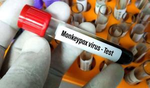 Portugal llega al centenar de casos confirmados de viruela del mono