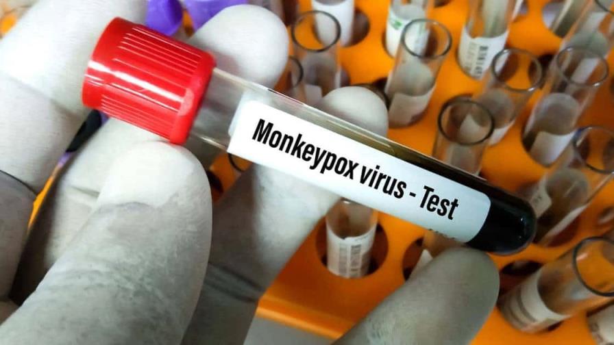 Portugal llega al centenar de casos confirmados de viruela del mono Portugal llega al centenar de casos confirmados de viruela del mono