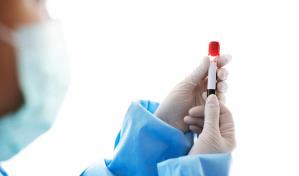 Skewes: caso sospechoso de viruela del mono en Haití estaría descartado