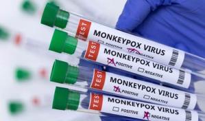 Ascienden a 44 los casos confirmados de viruela del mono en Alemania