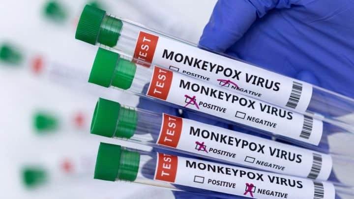 Ascienden a 44 los casos confirmados de viruela del mono en Alemania
