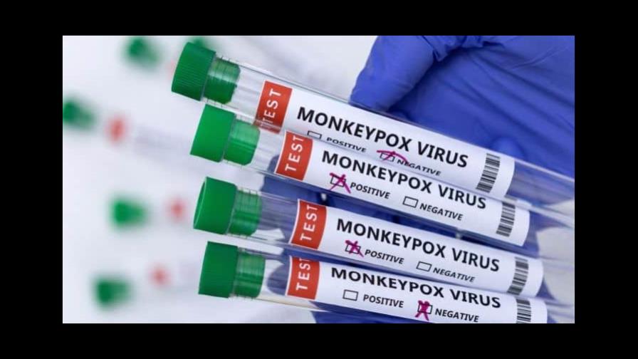 Ascienden a 44 los casos confirmados de viruela del mono en Alemania Ascienden a 44 los casos confirmados de viruela del mono en Alemania