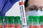 España recibirá de forma inminente 200 vacunas de la viruela del mono