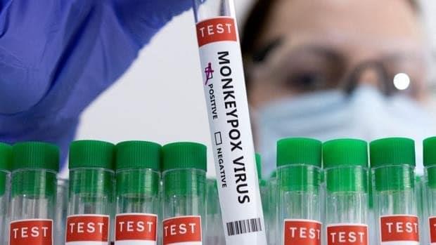España recibirá de forma inminente 200 vacunas de la viruela del mono