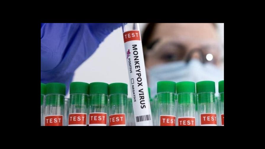 España recibirá de forma inminente 200 vacunas de la viruela del mono