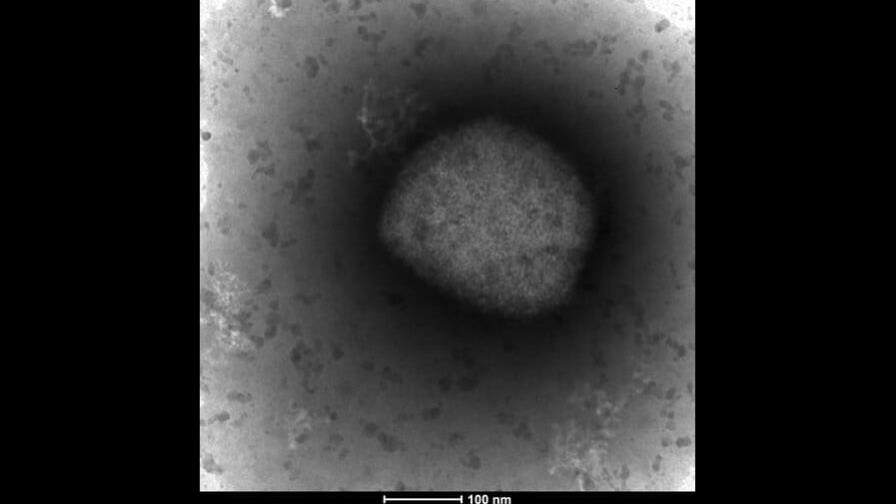 Detectan dos cepas de viruela símica en Estados Unidos