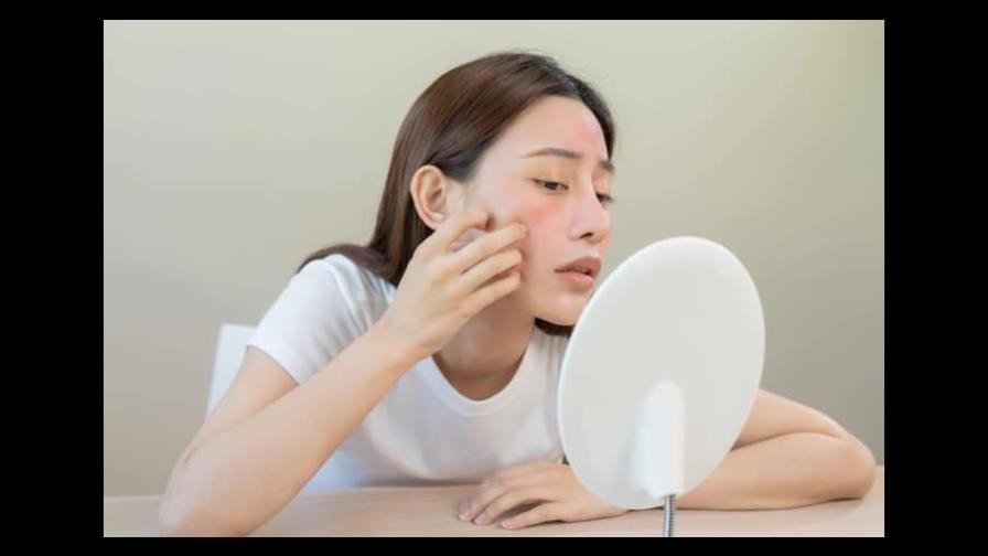 Estrés: las alteraciones que puede provocar en la piel Estrés: las alteraciones que puede provocar en la piel