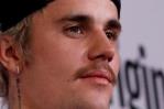 Justin Bieber pospone conciertos al sufrir una parálisis facial parcial