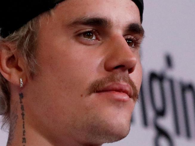 Justin Bieber pospone conciertos al sufrir una parálisis facial parcial