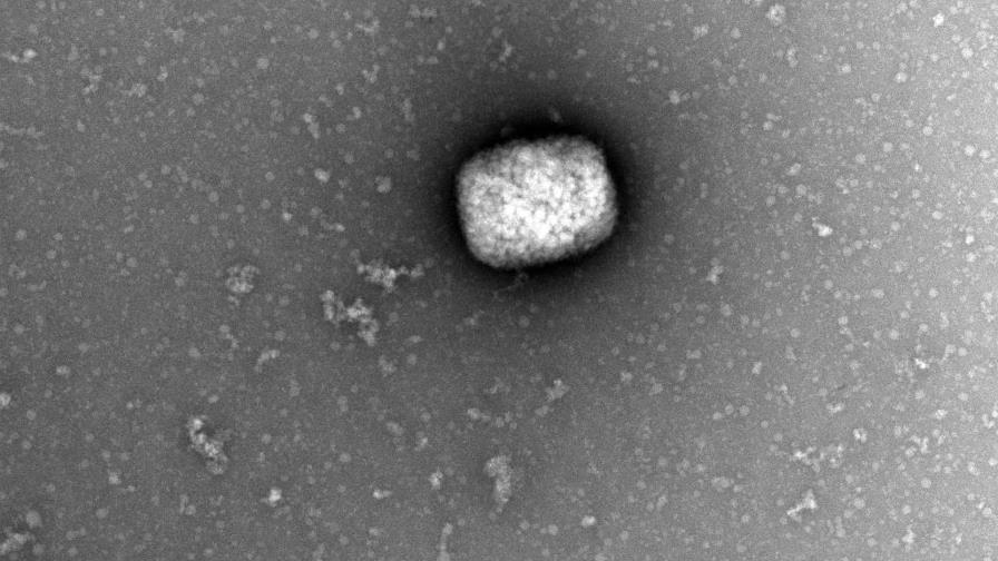 Detectan el primer caso de viruela del mono en Venezuela