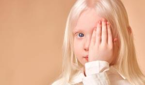 El albinismo: complicaciones visuales y protección solar