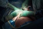 Médicos le cortan oreja a un bebé  durante una cesárea