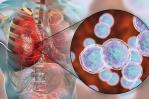 Revisan clínica con brote de neumonía en Argentina