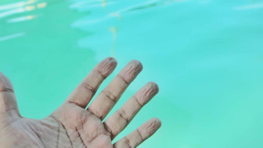 Por qué se arruga la piel con el agua y por qué es bueno Por qué se arruga la piel con el agua y por qué es bueno