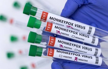 EE.UU. ofrecerá vacunas contra la viruela del mono a sospechosos de contagio