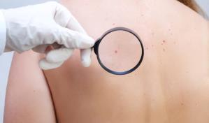 Puntos rojos en la piel: qué son y por qué aparecen