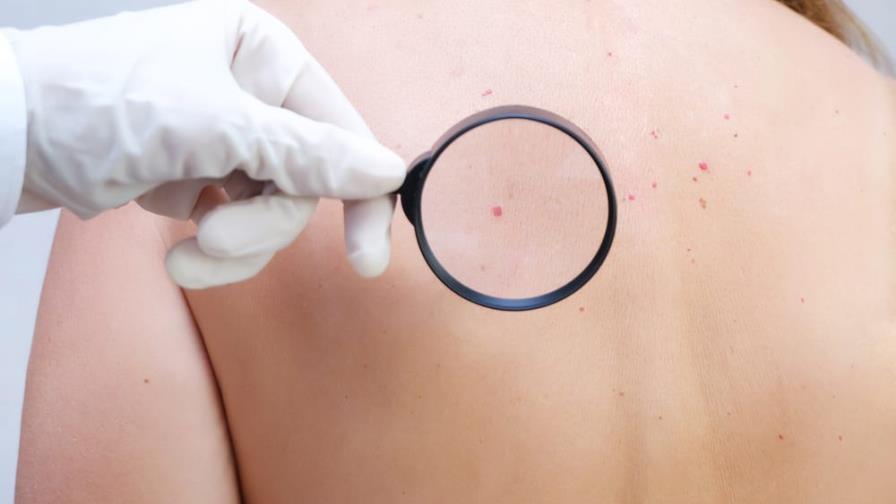 Puntos rojos en la piel: qué son y por qué aparecen Puntos rojos en la piel: qué son y por qué aparecen