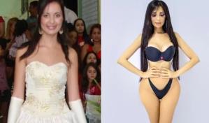 Joven gastó 600 mil dólares para parecerse a Kim Kardashian, ahora pagó para revertir las operaciones