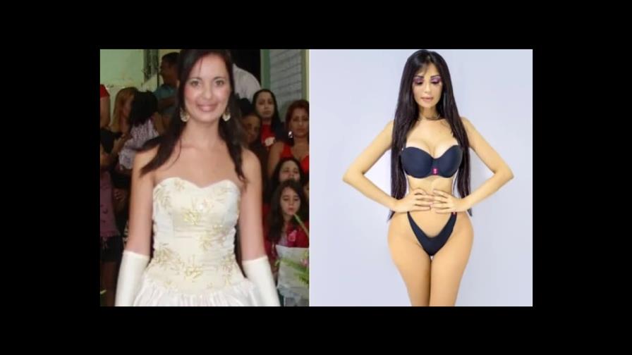 Joven gastó 600 mil dólares para parecerse a Kim Kardashian, ahora pagó para revertir las operaciones Joven gastó 600 mil dólares para parecerse a Kim Kardashian, ahora pagó para revertir las operaciones