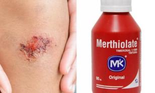 Es de Dominicanos: El mentiolé