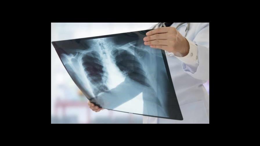 Guerras y pandemia contribuyeron al aumento de las muertes por tuberculosis en 2021 Guerras y pandemia contribuyeron al aumento de las muertes por tuberculosis en 2021