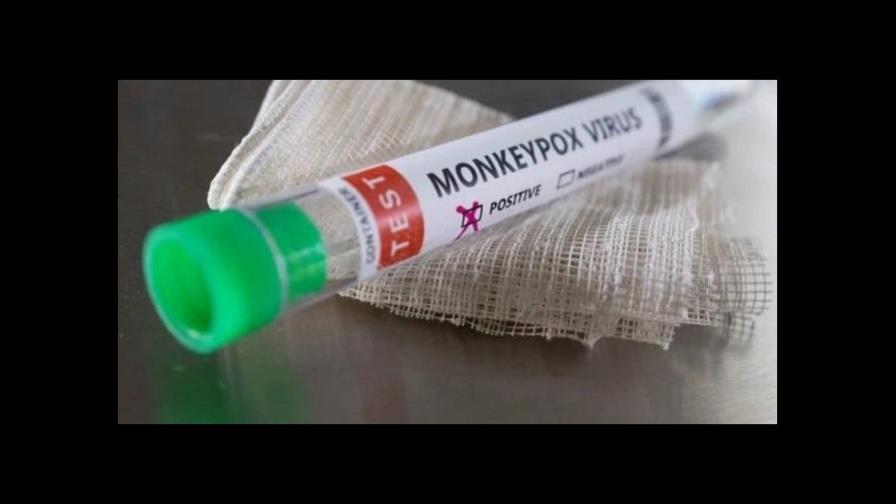 Casos globales de viruela del mono ascienden ya a 14,000 en más de 70 países Casos globales de viruela del mono ascienden ya a 14,000 en más de 70 países
