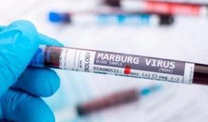 Nueve muertos en Guinea Ecuatorial por su primer brote del virus de Marburgo
