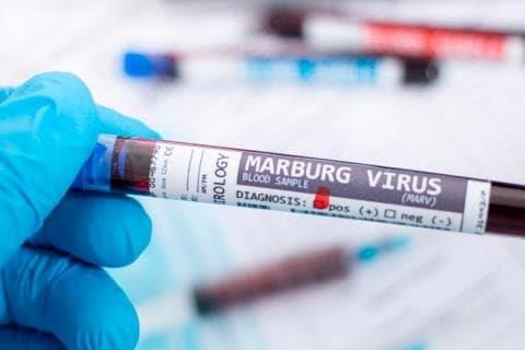 Ghana declara su primer brote de la enfermedad Marburgo, de la misma familia del ébola