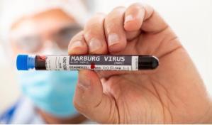 ¿Qué es  Marburgo, el virus que ya ha matado a dos personas?