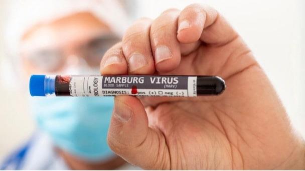 ¿Qué es  Marburgo, el virus que ya ha matado a dos personas?
