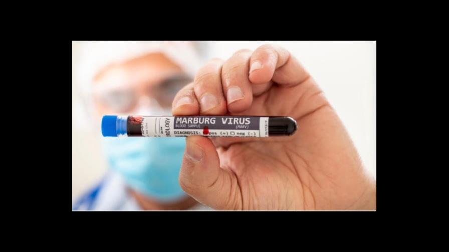 ¿Qué es  Marburgo, el virus que ya ha matado a dos personas?