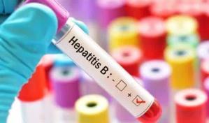 El 95 % de niños con hepatitis B en México tienen riesgo de complicaciones