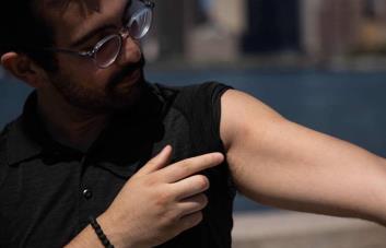 Los peores dolores de mi vida: un neoyorquino cuenta su sufrimiento con la viruela del mono