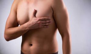 La ginecomastia y su efecto en la autoestima masculina La ginecomastia y su efecto en la autoestima masculina