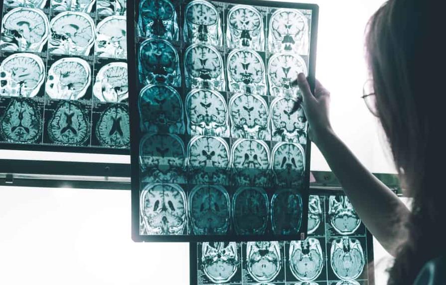 Expertos de Florida estudian el uso de ultrasonido en pacientes con Alzheimer
