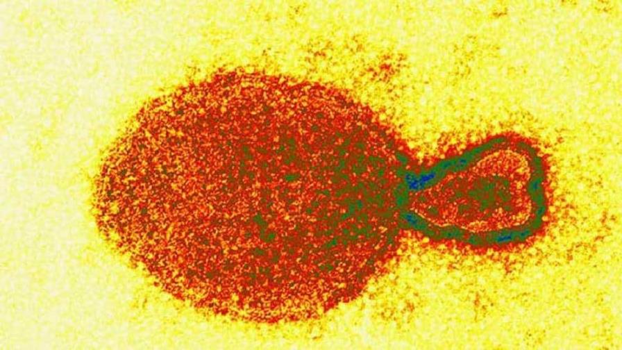 Detectan en China 35 casos en humanos de un nuevo virus de origen animal Detectan en China 35 casos en humanos de un nuevo virus de origen animal