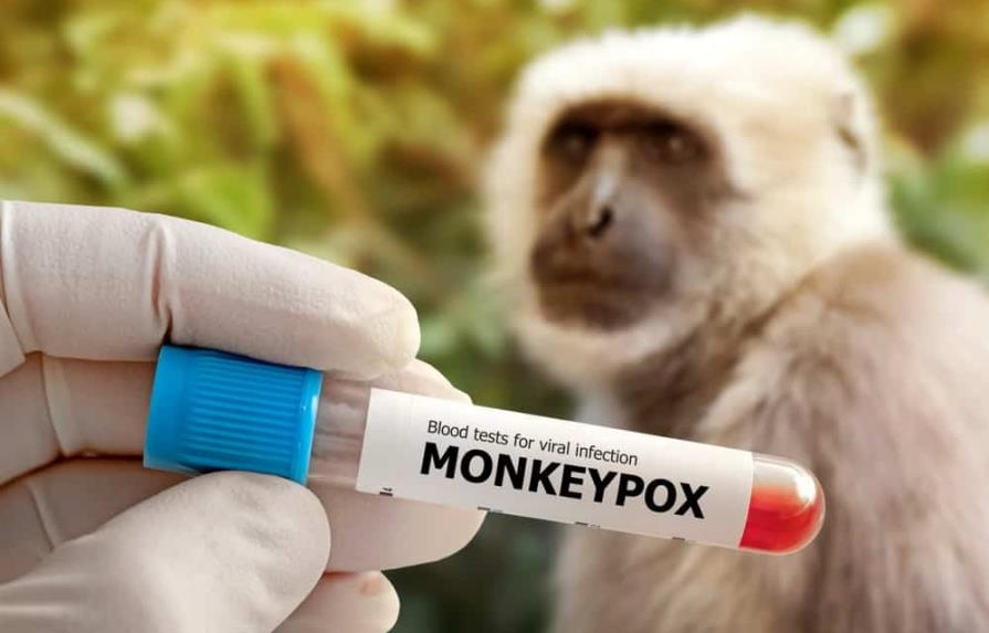 Viruela del mono: cuáles son los tratamientos y las vacunas