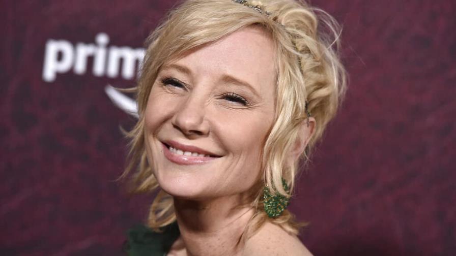 Anne Heche en soporte vital, no se espera que sobreviva Anne Heche en soporte vital, no se espera que sobreviva