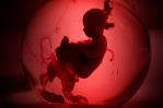 Veto al aborto en estados del sur de EEUU desborda clínicas de la vecina Florida Veto al aborto en estados del sur de EEUU desborda clínicas de la vecina Florida