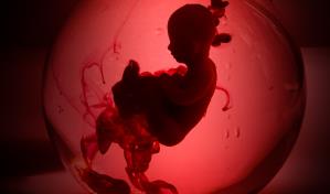 Veto al aborto en estados del sur de EEUU desborda clínicas de la vecina Florida