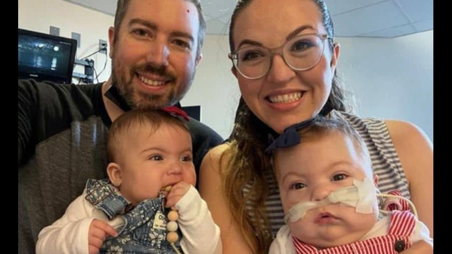 Niña nacida con un pulmón y con un 20 % de posibilidades de sobrevivir se va a casa tras cirugía