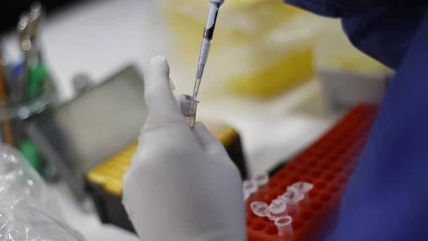 EE.UU. impulsa la vacunación sin cita para frenar la viruela del mono