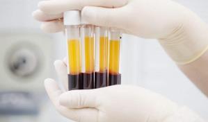 Qu&eacute; es la "sangre dorada", el inusual grupo sangu&iacute;neo que solo tienen 50 personas en el mundo