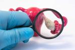 Nuevos tratamientos en cáncer de ovario logran supervivencias del 70 % a 7 años Nuevos tratamientos en cáncer de ovario logran supervivencias del 70 % a 7 años
