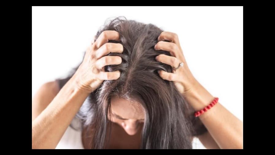 Estos son los motivos por los que te pica el cuero cabelludo