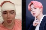 Gastó 152,000 dólares en cirugías para parecerse a Jimin de BTS Gastó 152,000 dólares en cirugías para parecerse a Jimin de BTS