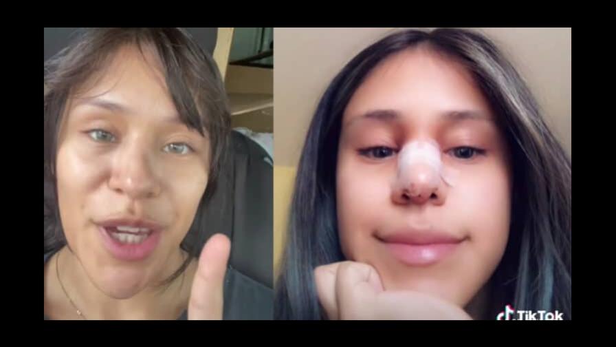 Mujer perdonó infidelidad a su pareja, le pidió una cirugía a cambio