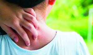 Es posible controlar la dermatitis atópica en niños y adolescentes