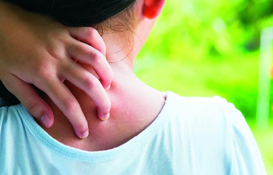 Es posible controlar la dermatitis atópica en niños y adolescentes