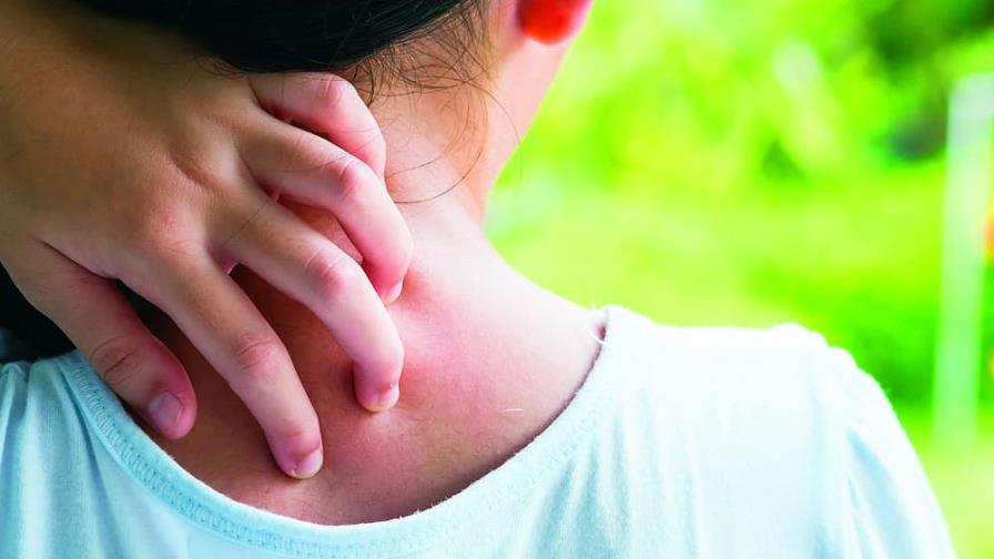 Es posible controlar la dermatitis atópica en niños y adolescentes